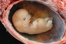 Embrion po całkowicie samoistnym poronieniu w ok. 6. tygodniu od poczęcia, Wikipedia