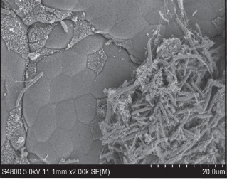 Mikrokolonie bakterii Clostridium difficile, obraz ze skaningowego mikroskopu elektronowego, doi:10.1371/journal.ppat.1002995.g001