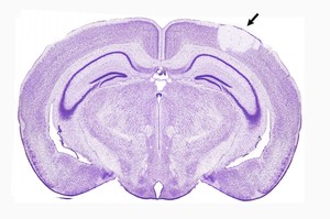 Udar niszczy strukturę tkanki nerwowej. Na preparacie mózgu szczura komórki są wybarwione na fioletowo. Strzałka wskazuje miejsce udaru, w którym komórki obumarły. (Źródło: Instytut Nenckiego)
